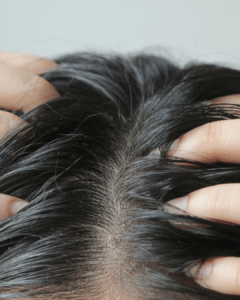 diagnostic capillaire en salon analyse cuir chevelu professionnel